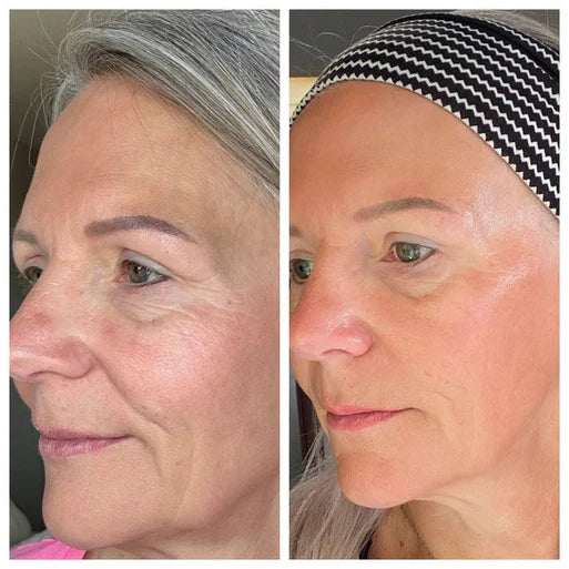 Before and after results showing visible age reversal and improved skin radiance